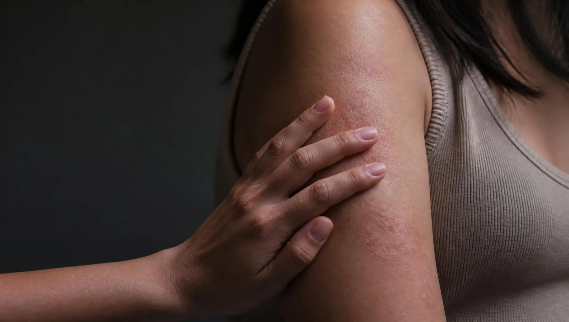 Mão acolhendo o braço de uma mulher com lesões de pele, em luz suave